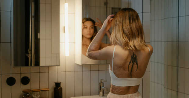 Psicólogos para tratar problemas de autoestima